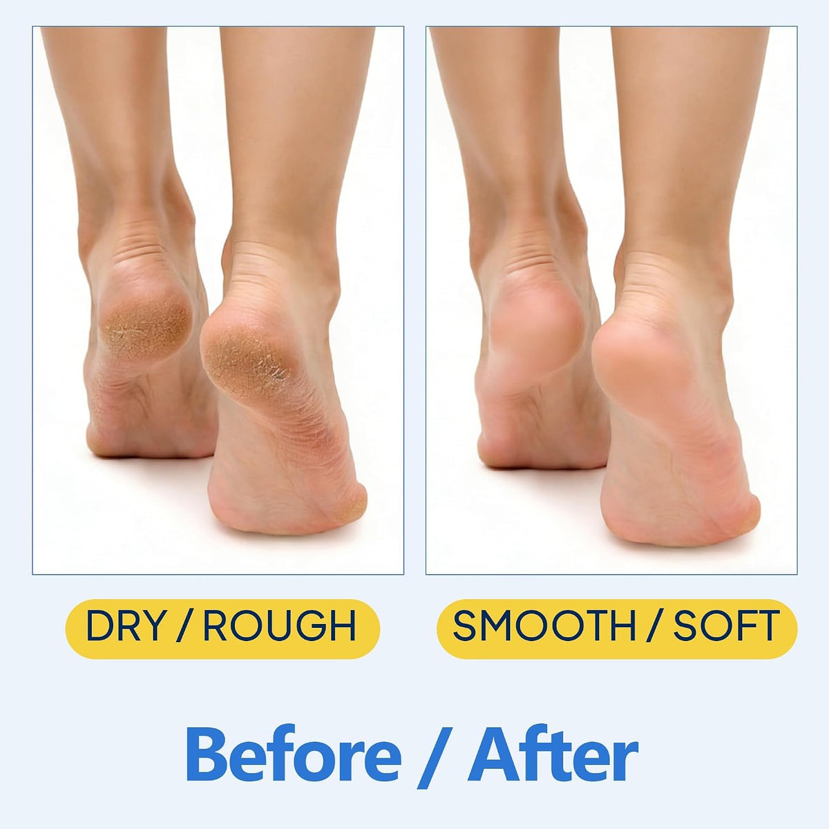 Sola Comfort Stick